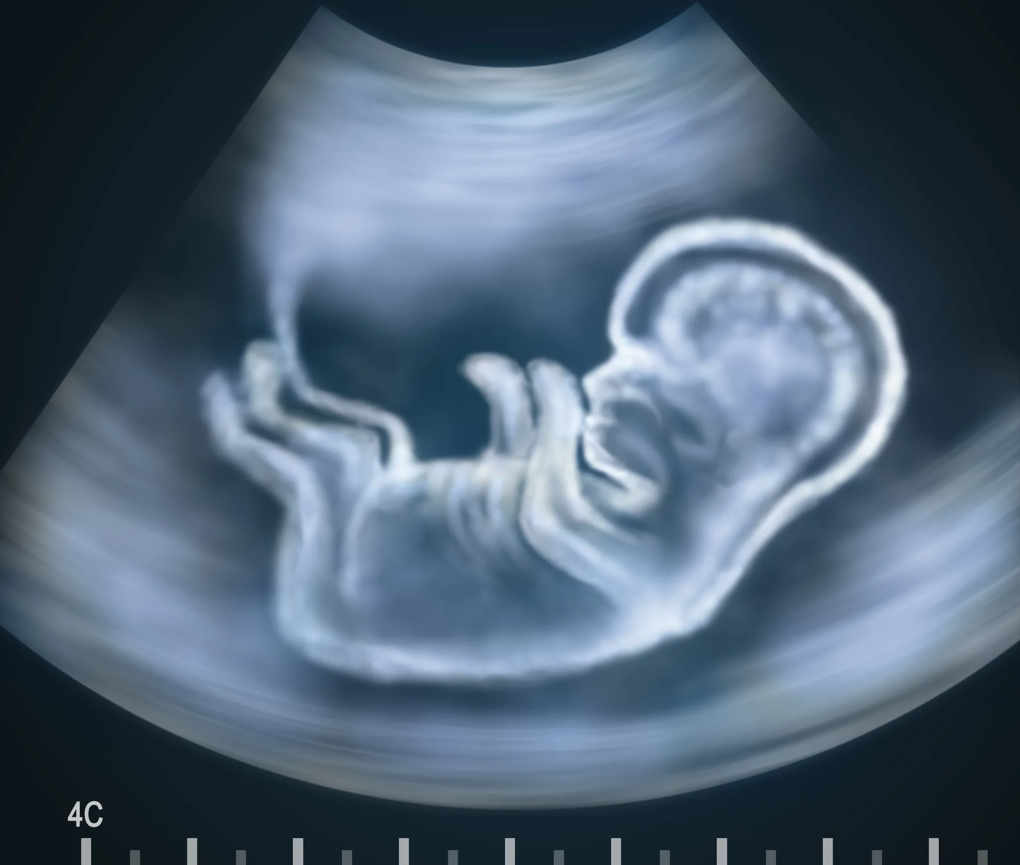 AI-ML-in-Prenatal-and-Antenatal-care-image
